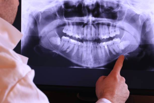 Best Emergency Gum Treatment in Whitehouse, OH