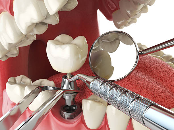 Best Pediatric Emergency Dentist in Whitehouse, OH